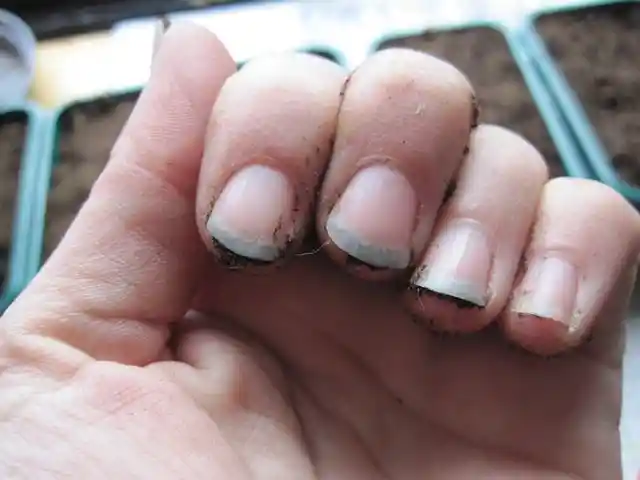 6. Dirty Fingernails