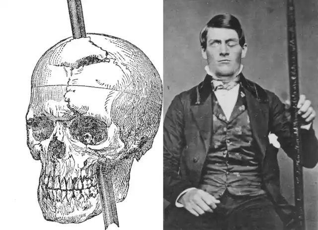 The Day of the Accident of Phineas Gage