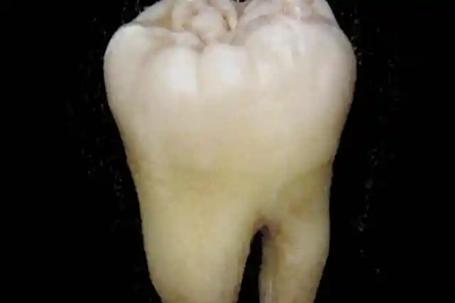 The Tooth