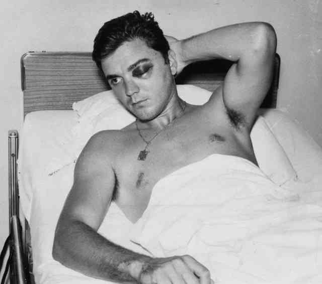 A fastball from California Angels Jack Hamilton damaged the retina in Tony Conigliaro's left eye, cracked his left cheekbone and dislocated his jaw. The incident caused Tony to miss the entire 1968 season.