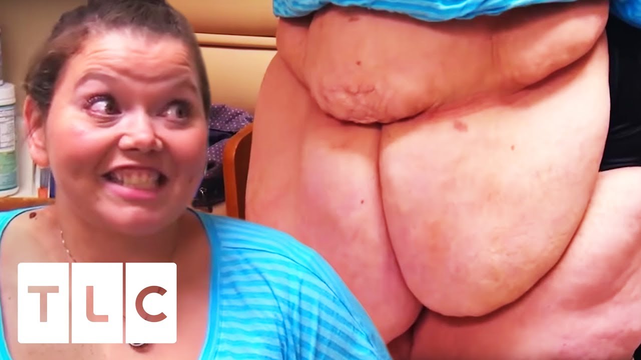 You Won’t Believe The Amazing “After” Photos From My 600 LB Life